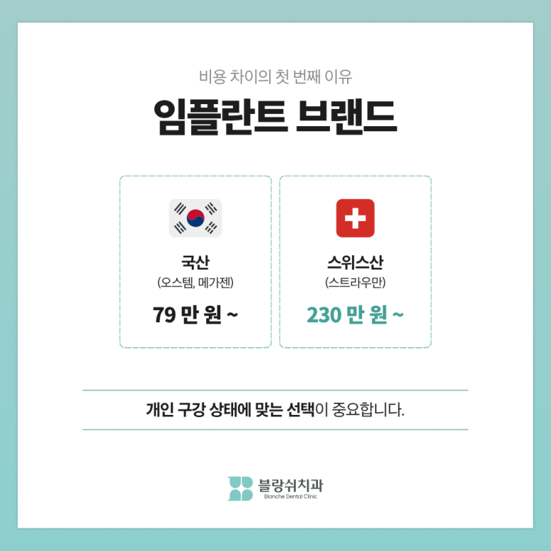 부분임플란트, 하나만 심으면 되는데 왜 비용 차이가 3배까지 날까? 관련 이미지 3