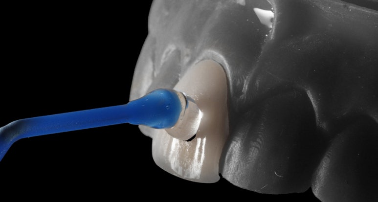 블랑쉬 부작용 문의? 관련 이미지 4