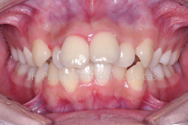 실력 있는 교정치과를 찾는 3가지 방법 관련 이미지 5