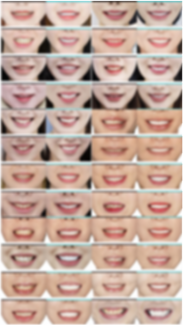 무삭제라미네이트후기? 이것만이 전부가 아닙니다 관련 이미지 1