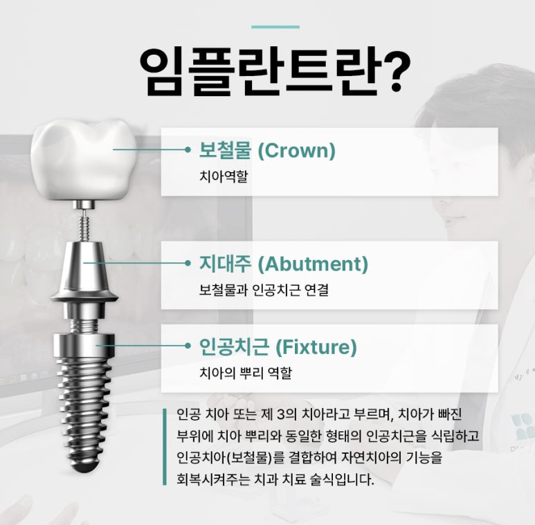 수면임플란트센터, 프리미엄 임플란트 진료는 블랑쉬치과(Blanche Dental Clinic) 관련 이미지 3