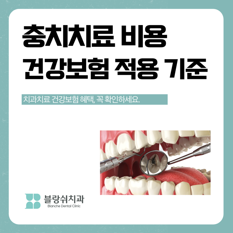 충치치료 비용 건강보험 적용 기준은 관련 이미지 1