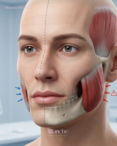 Facial Asymmetry? If Your Jaw Makes a Sound, Check This at Home First! image 14