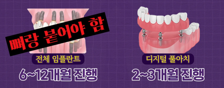 노인틀니 vs 디지털풀아치, 부모님 씹는 힘 2배 높이는 선택 기준 관련 이미지 7