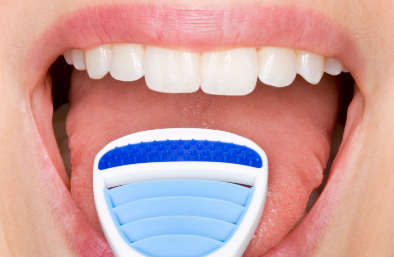 You Brush Thoroughly, but Still Have Bad Breath? 4 Real Causes Your Toothbrush Can’t Reach image 3