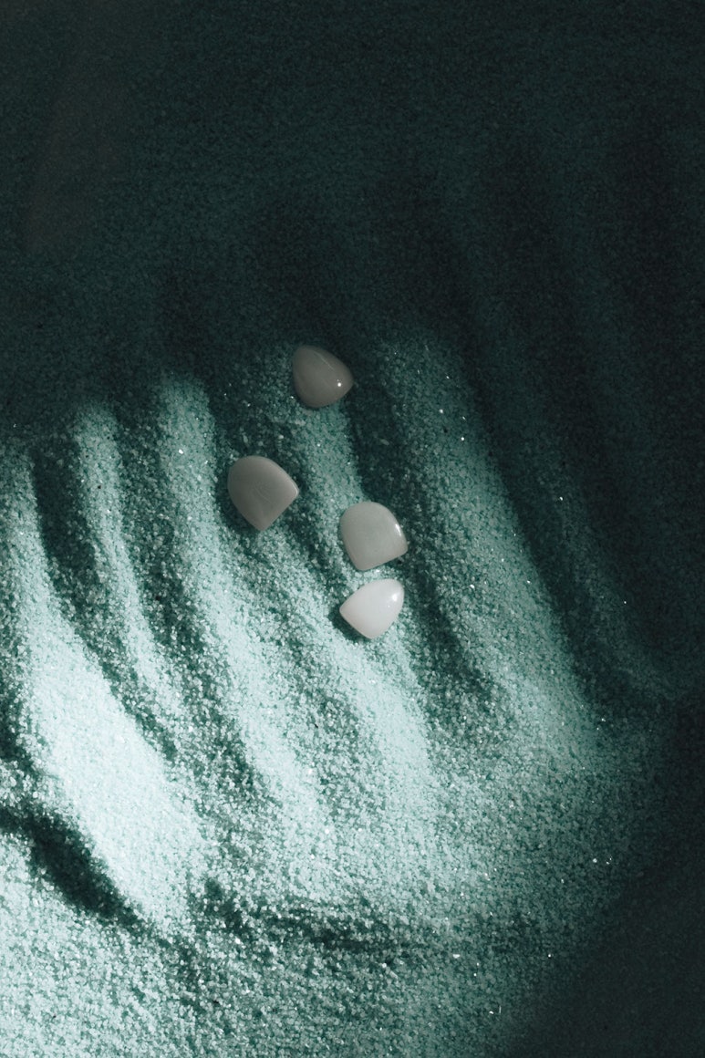 If You’re Worried About Side Effects of No-Prep Laminates image 4