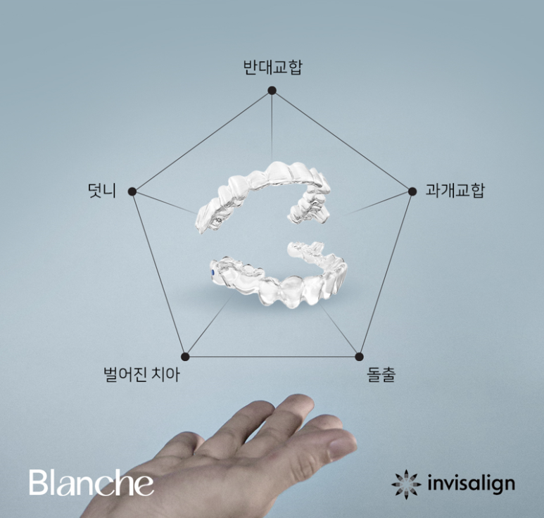 일반 투명교정 대신 인비절라인 하세요! 관련 이미지 8