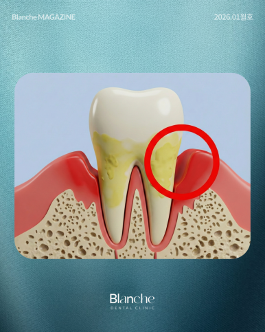 양치할 때 "이것"만 보고 따라하시면 치과 오는 일 적어집니다 관련 이미지 9