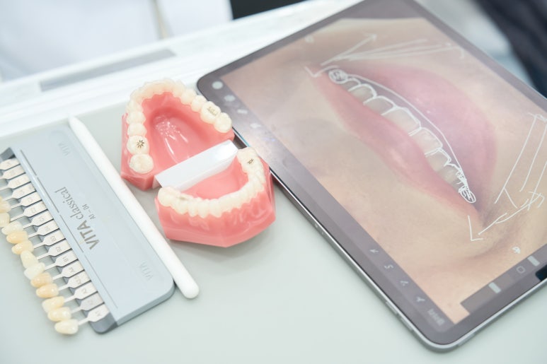 무삭제라미네이트 가격과 핵심 정보를 정리해볼게요 관련 이미지 13