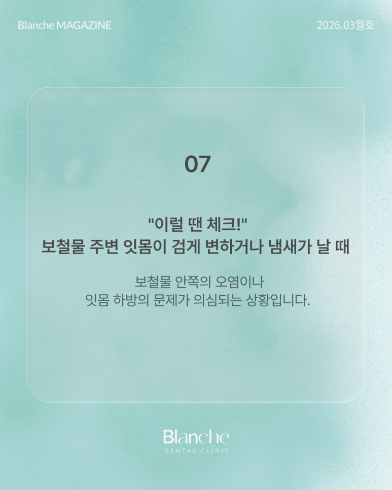 옛날에 한 라미네이트, 요즘 자꾸 신경 쓰인다면? 관련 이미지 12