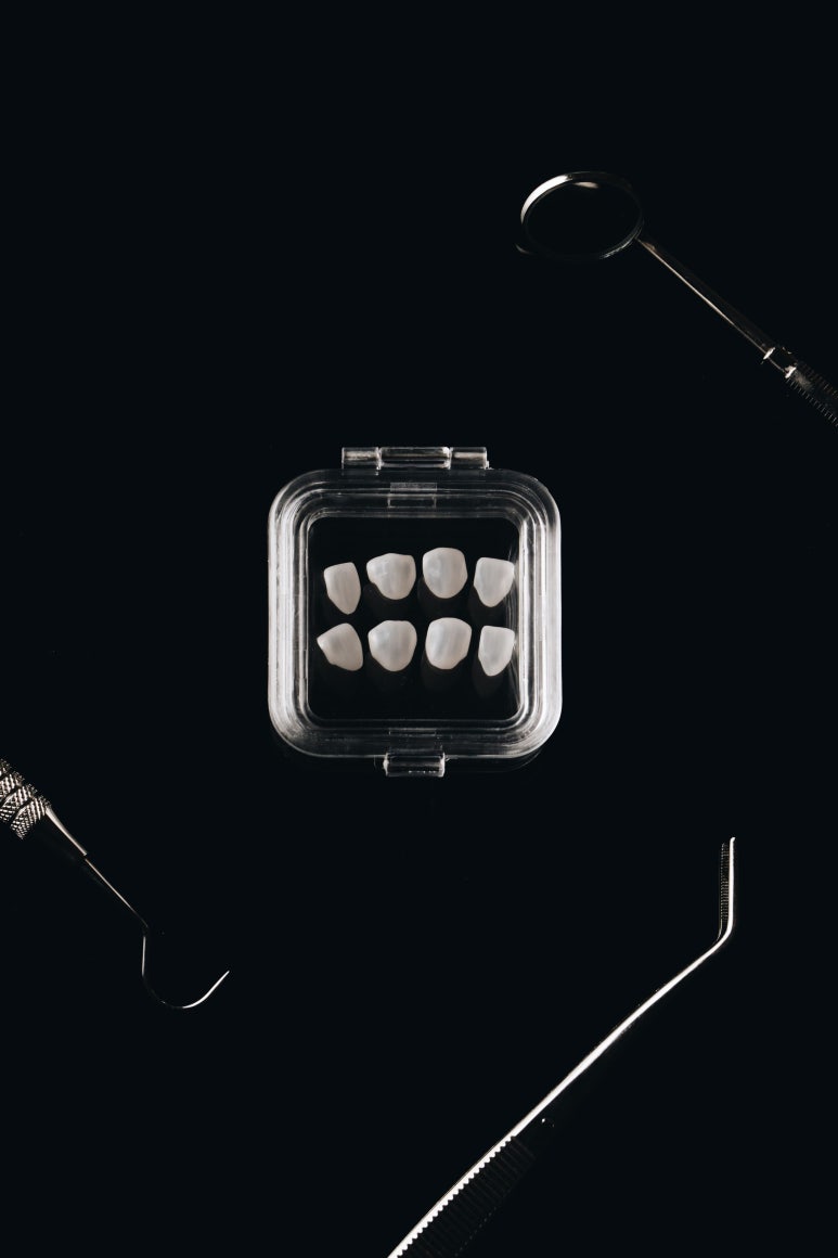 무삭제 라미네이트 부작용, 모르고 진행하면 손해보는 이유 관련 이미지 7