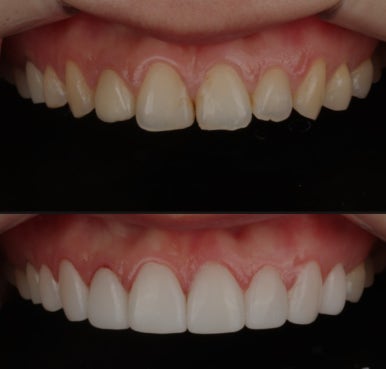 무삭제라미네이트 가격, 어떤 점을 알아보면 좋을까요? 관련 이미지 2