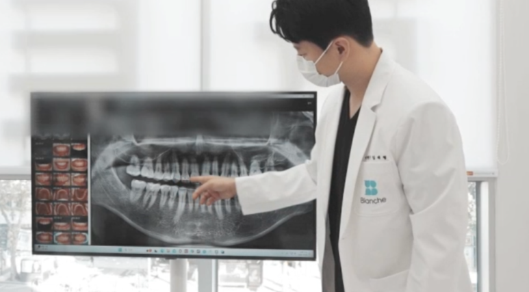 In an Era When Implants Have Become Easier, Why Are Healthy Natural Teeth Being Extracted Too Quickly? image 4