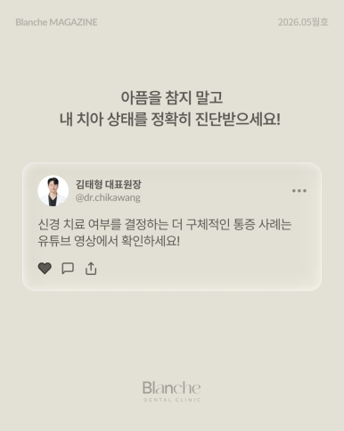 신경 치료, 아프면 무조건 해야 할까요? 자가 체크 가이드 관련 이미지 16