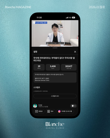 무삭제 라미네이트는 "부작용"이 없다? 관련 이미지 12