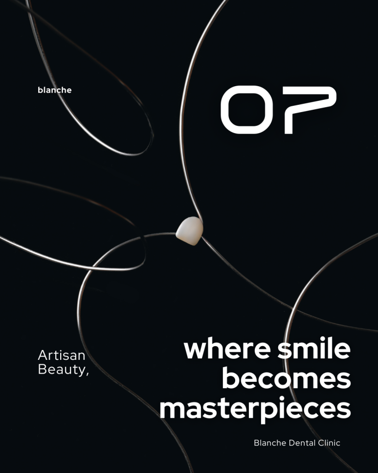 블랑쉬 라미네이트 솔루션 사례 (치아착색개선) 관련 이미지 5