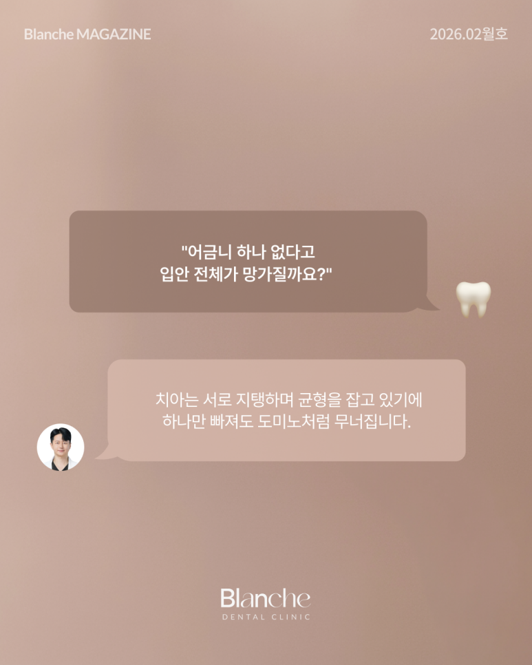 어금니 뺀 자리, 당장 안 아픈데 꼭 임플란트 해야 할까? 관련 이미지 5