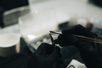 앞니무삭제라미네이트, 정말 잘 알고 계신가요? 관련 이미지 8