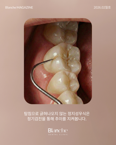 "혹시 과잉진료?" 양심 치과 구별하는 3가지 방법 관련 이미지 6