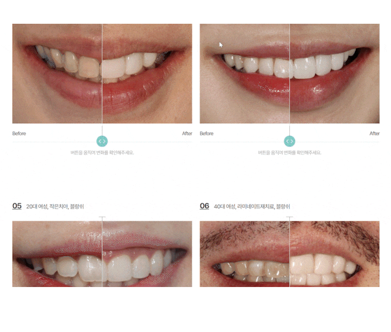 블랑쉬 부작용 문의? 관련 이미지 14