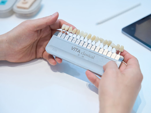 무삭제라미네이트 비용에 관한 숨겨진 진실, 모두 공개합니다. 관련 이미지 9