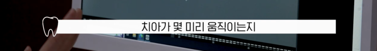 신사동 교정치과 인비절라인 가격 과정 알려드림 관련 이미지 12