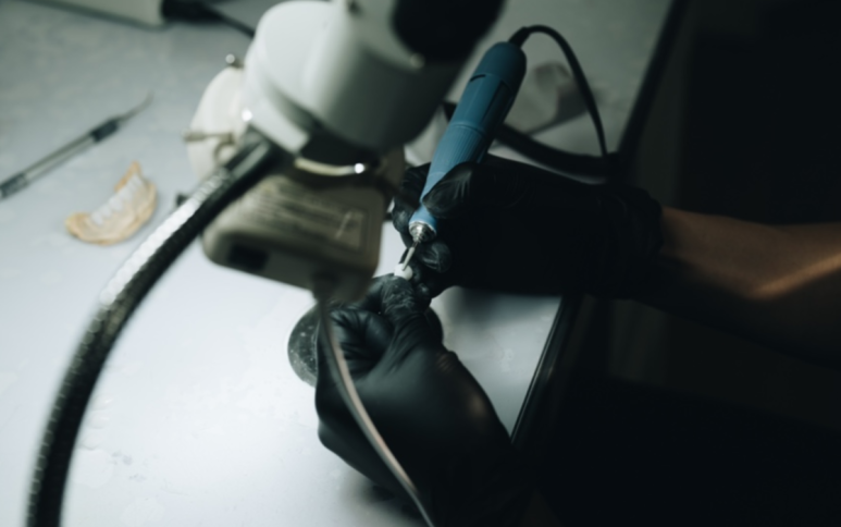 The Differences Between Implant Types: How a Dentist Who Has Placed 30,000 Implants Really Chooses a Brand image 5