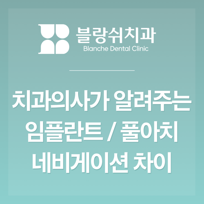 서초동 전체 임플란트 vs 풀아치 차이점 기간 뭐가 다를까? 관련 이미지 1