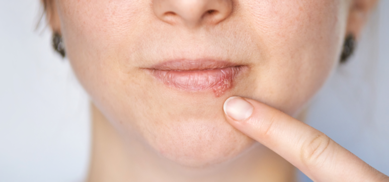 Tongue Tip Pain and Tongue Root Pain: Dentists Suspect Different Causes Depending on the Location image 5