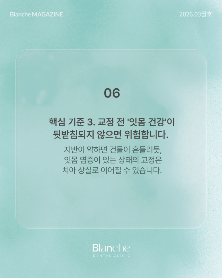 치아 교정 전 관련 이미지 9