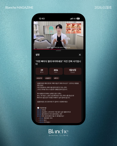 "임플란트 뼈이식, 무조건 해야 하나요?" 과잉진료 피하는 법 관련 이미지 17