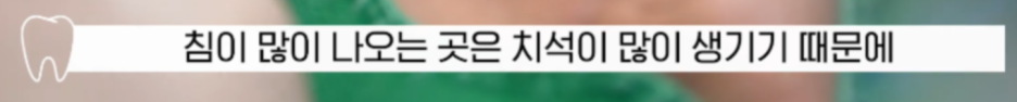 (피나는)잇몸 스케일링 방치하면 위험한 이유 관련 이미지 3