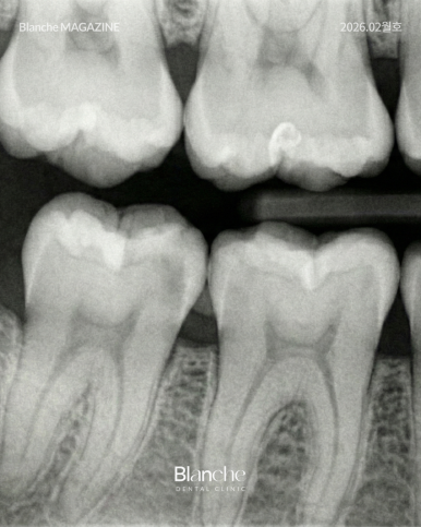 "혹시 과잉진료?" 양심 치과 구별하는 3가지 방법 관련 이미지 8