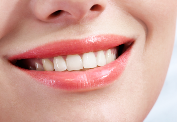 2 Factors Behind Differences in Orthodontic Costs: Something Else Matters More Than the Appliance image 5