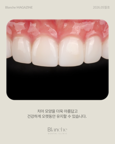 Black Gaps Between Teeth After Orthodontic Treatment image 9