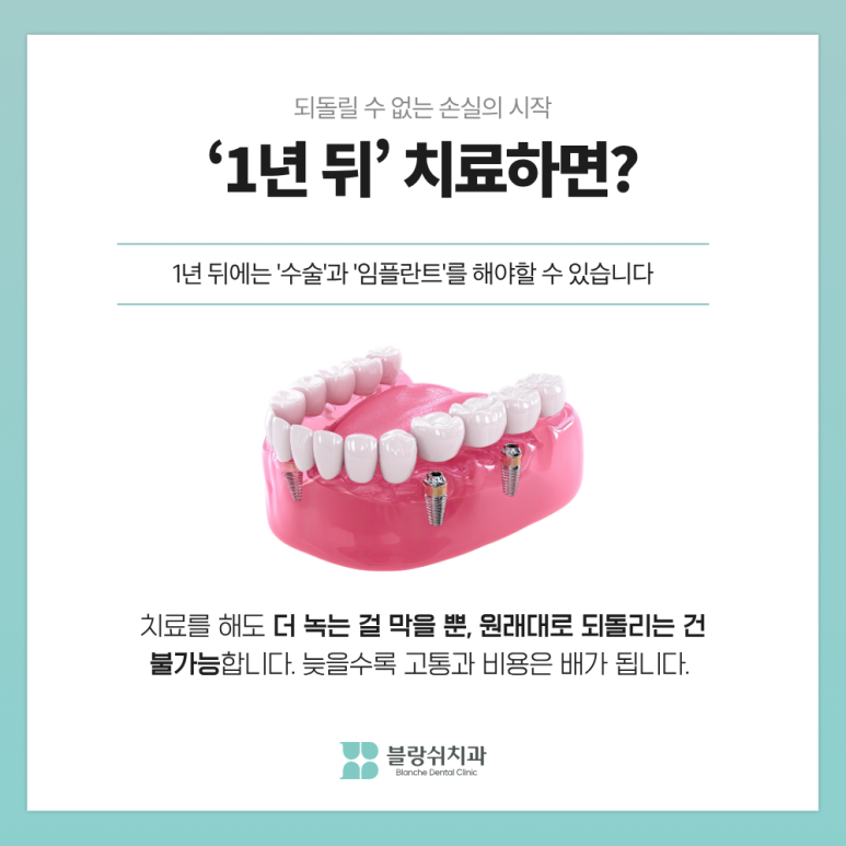 치주염 치료, 지금이랑 1년 뒤랑 뭐가 다를까요 관련 이미지 5