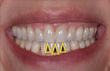 인생을 바꾸고 싶다면, 미소를 바꾸세요. 관련 이미지 8