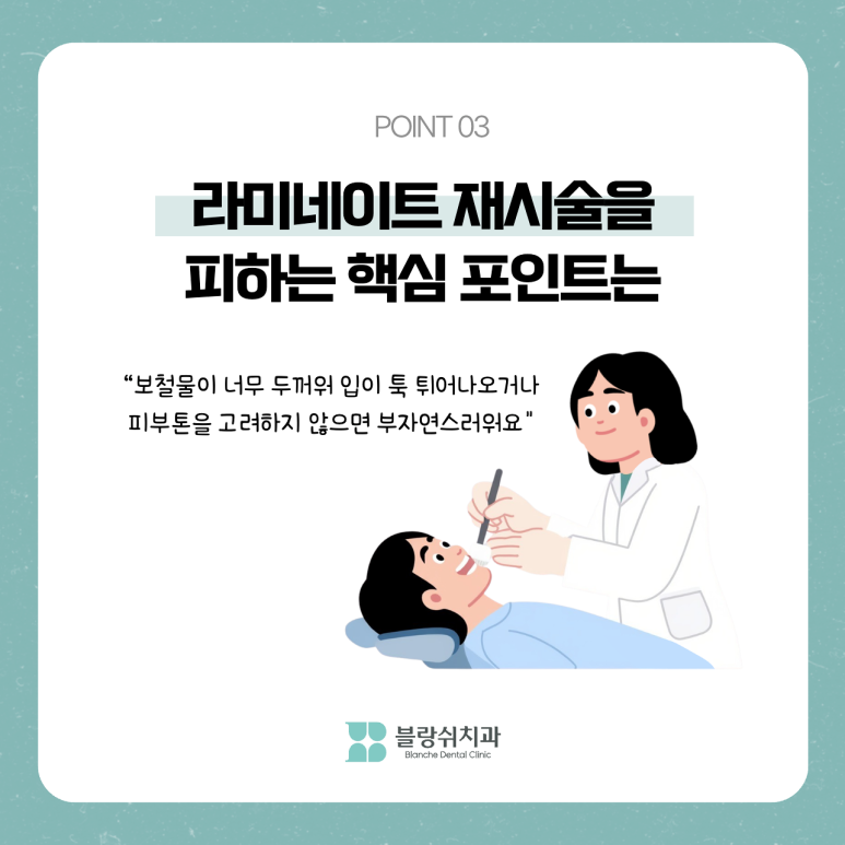 라미네이트 부작용 치아 삭제 전 반드시 알아야 할 것 관련 이미지 7