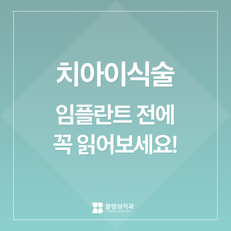 치아이식술 성공률 높이는 핵심 조건 3가지, 임플란트 전에 꼭 읽어보세요 관련 이미지 1