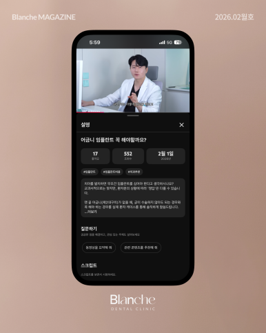 어금니 뺀 자리, 당장 안 아픈데 꼭 임플란트 해야 할까? 관련 이미지 17