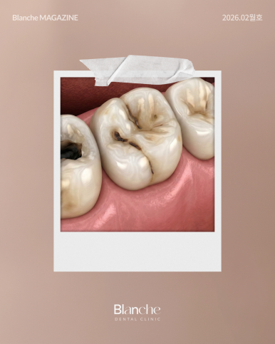 "혹시 과잉진료?" 양심 치과 구별하는 3가지 방법 관련 이미지 3