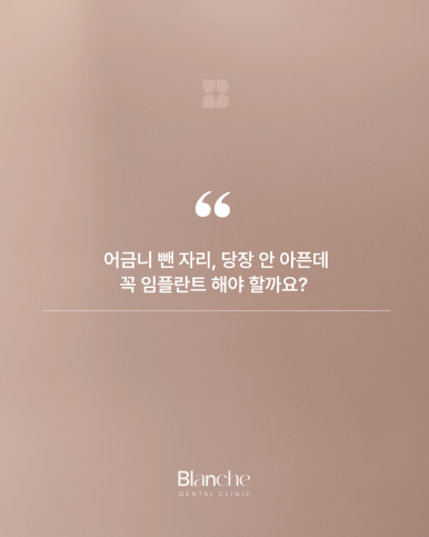 어금니 뺀 자리, 당장 안 아픈데 꼭 임플란트 해야 할까? 관련 이미지 1