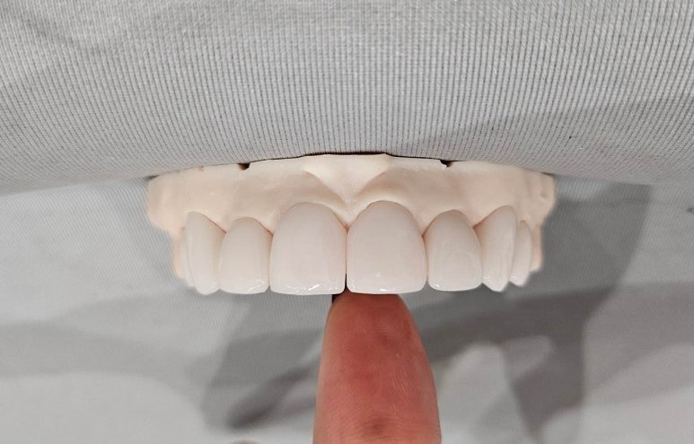 무삭제라미네이트가격, 2가지가 결정합니다 관련 이미지 4