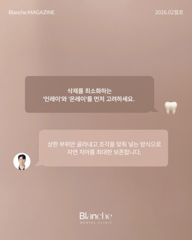 충치 치료, 무조건 깎아서 씌워야 할까? 관련 이미지 6