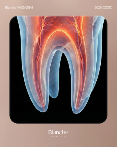충치 치료, 무조건 깎아서 씌워야 할까? 관련 이미지 9