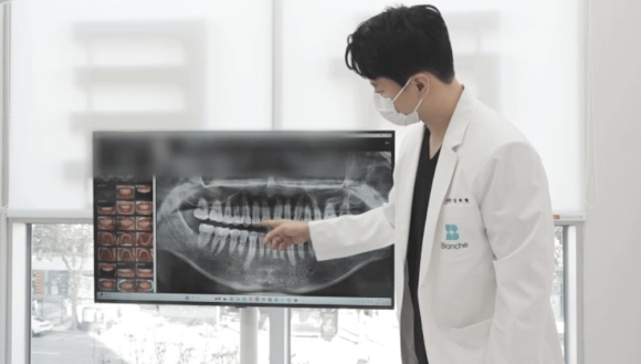 어금니 임플란트 뼈이식 통증 비용 총정리 관련 이미지 11