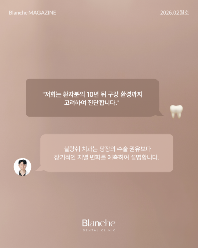 어금니 뺀 자리, 당장 안 아픈데 꼭 임플란트 해야 할까? 관련 이미지 14