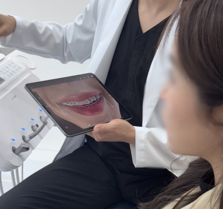 자가치아미백? 이것만으로는 어려운 이유 관련 이미지 7