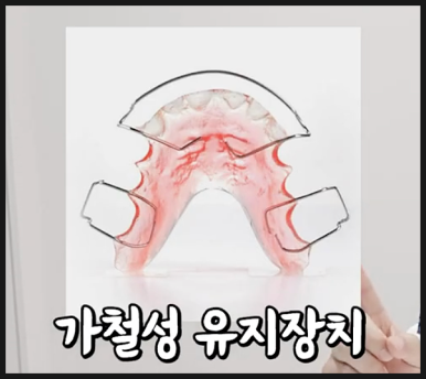 압구정치과 치아교정이 고민이라면 필독 관련 이미지 13