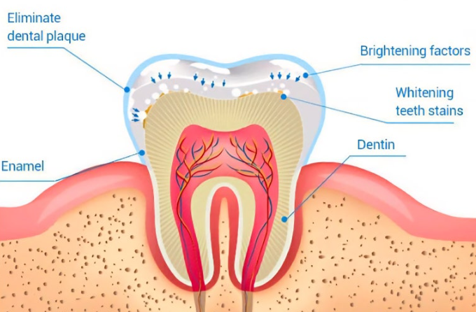 At-Home Teeth Whitening vs. Professional Dental Whitening: Which Should You Choose? image 4